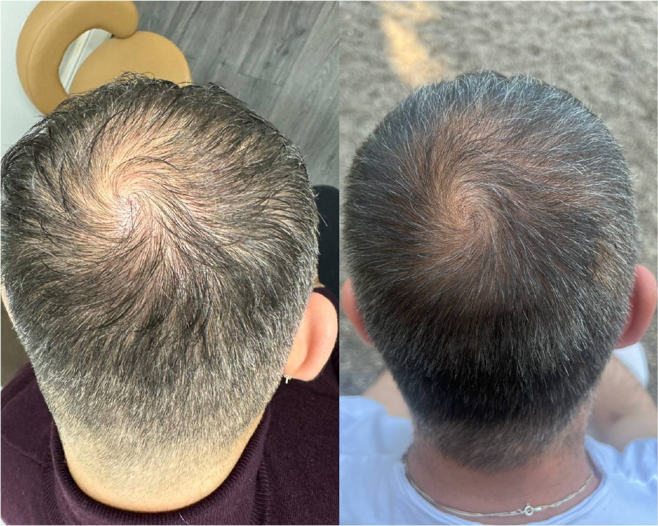 What to Do Before the Treatment?